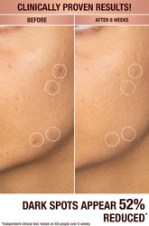 Charlotte Tilbury Dark Spot Correcting Radiance Serum (sample size)